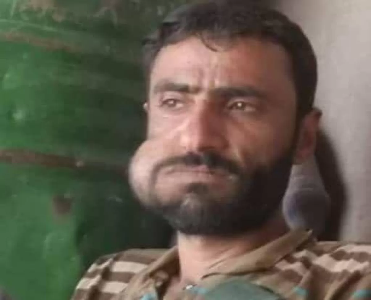 مقتل قيادي حوثي على يد مسلح قبلي في محافظة الجوف