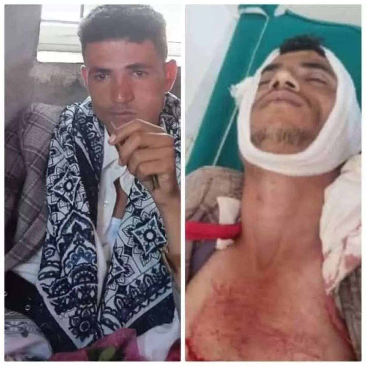 مقتل شاب برصاص عناصر جماعة الحوثي في نقطة جبايات بحيمة تعز