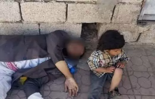 حادثة وفاة مواطن جوعًا تكشف مأساة اليمنيين في مناطق سيطرة جماعة الحوثي
