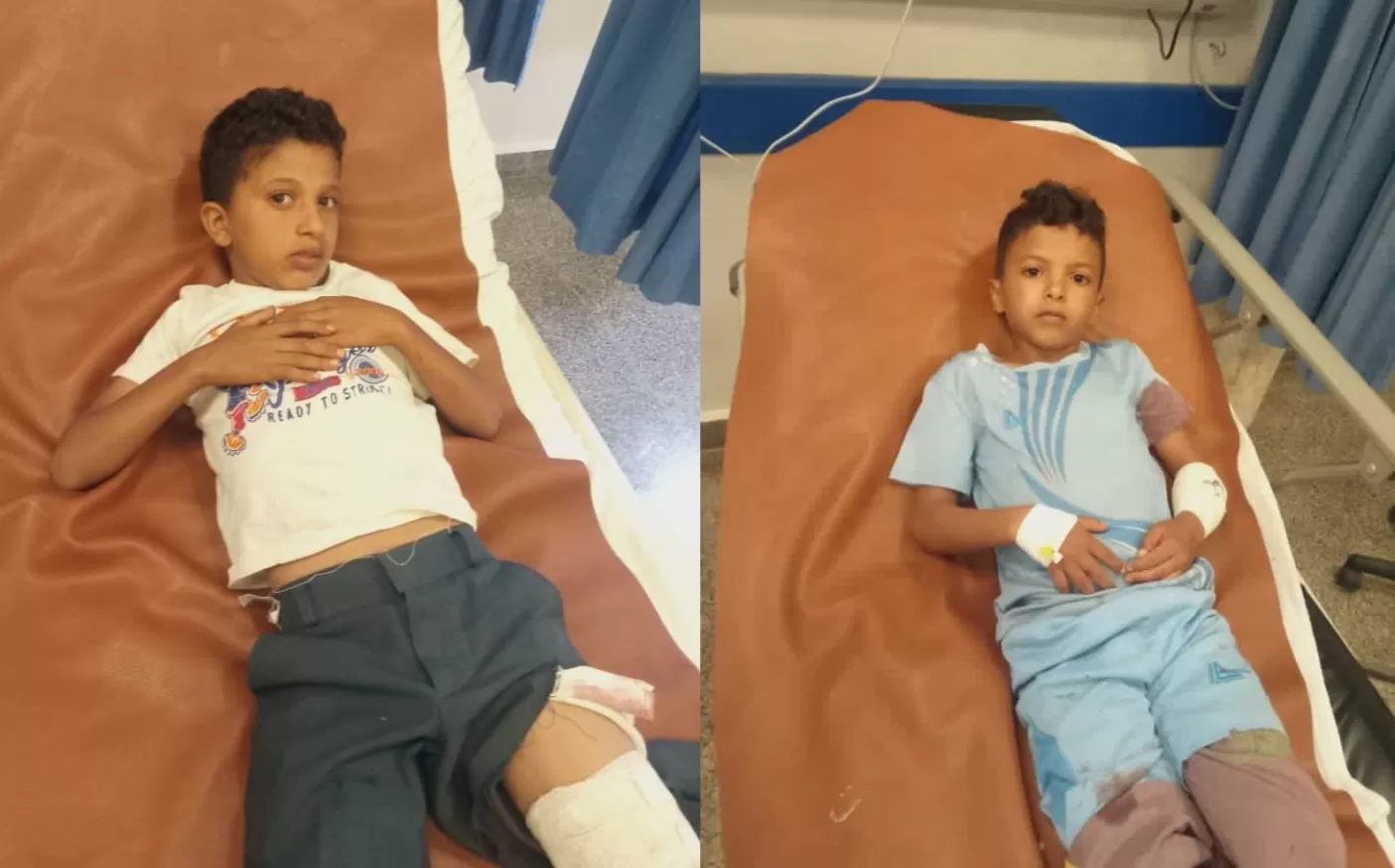 إصابة طفلين بانفجار مقذوف حربي من مخلفات الحوثيين غربي تعز