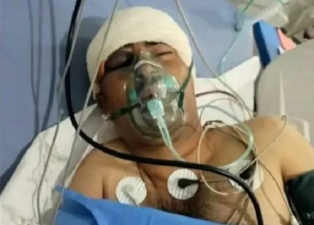 مسلحون يعتدون على بائع في إب بسبب رفضه دفع جبايات غير قانونية