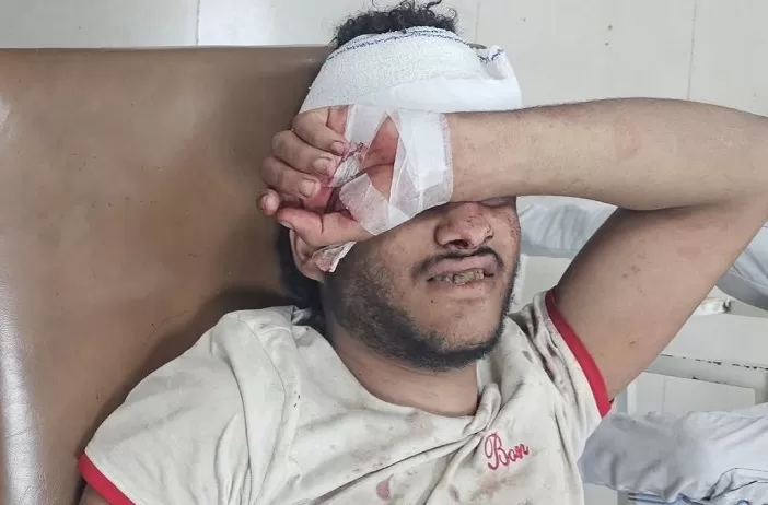 إصابة شاب برصاص قناصة الحوثيين شرق تعز
