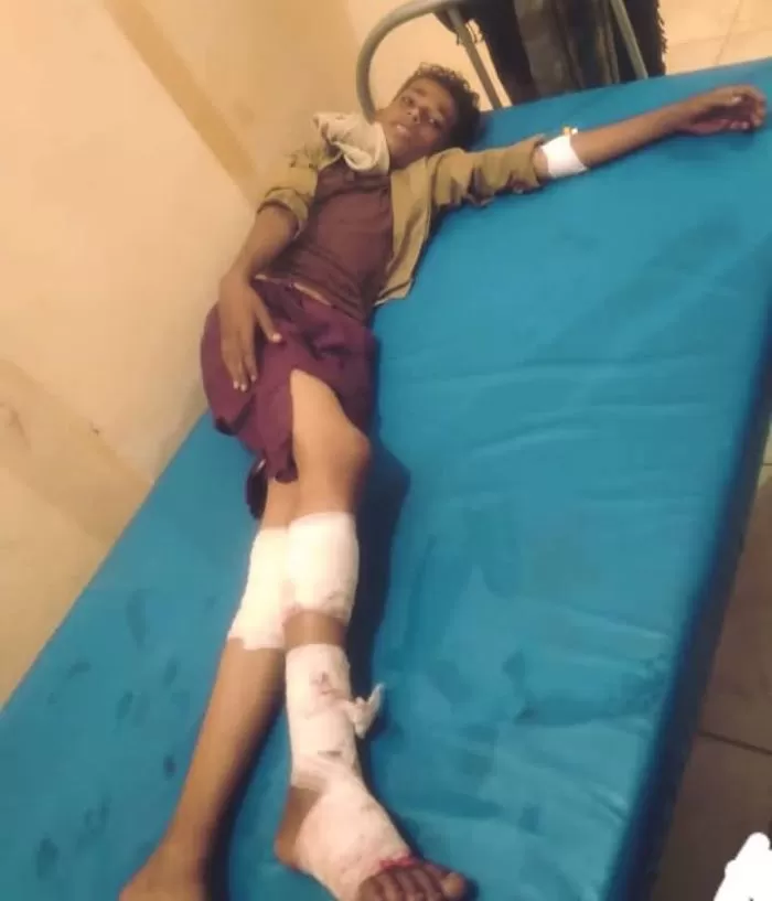 تعز : إصابة طفل بانفجار مقذوف من مخلفات الحوثيين في الوازعية