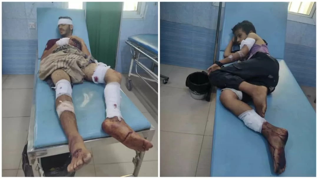 إصابة شقيقين أحدهما طفل في انفجار عبوة ناسفة من مخلفات الحوثيين شرق تعز