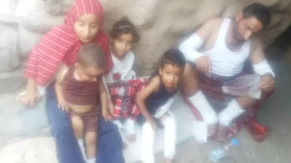 إصابة أسرة كاملة بانفجار أسطوانة غاز شمال إب