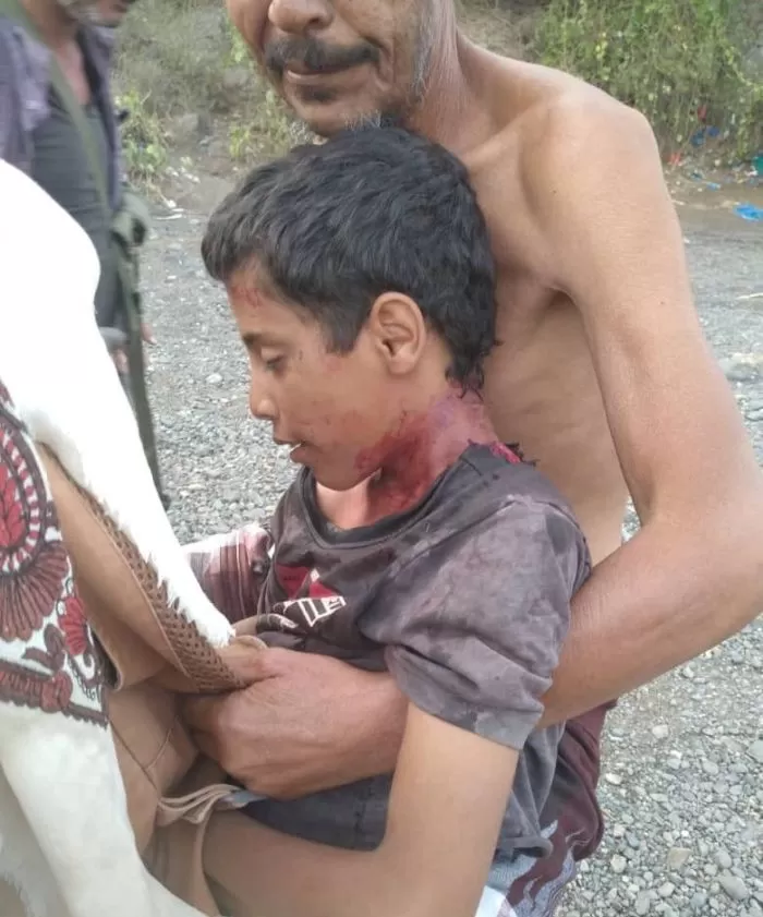 إصابة طفل برصاص قناصة الحوثيين شمال لحج