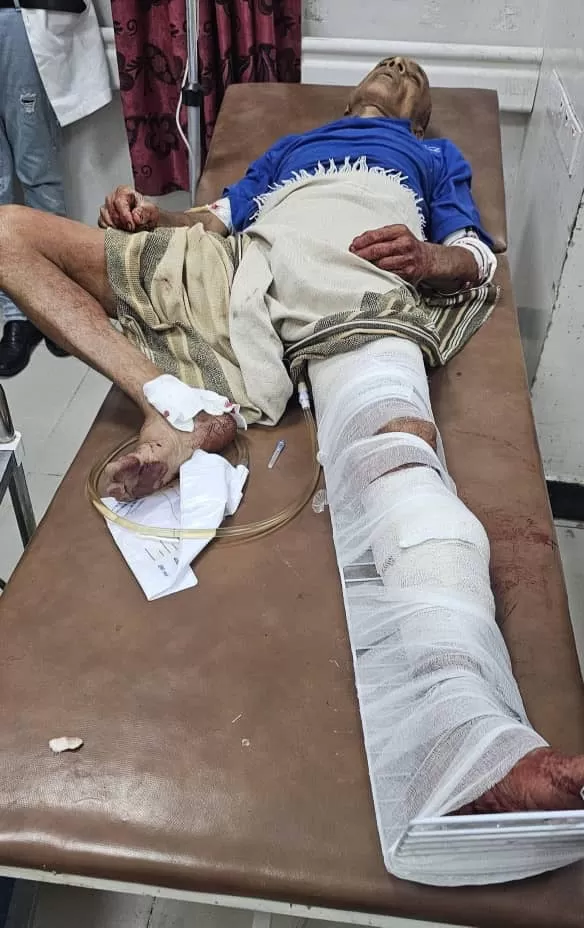 قناصة الحوثي يستهدفون مواطنًا جوار منزله شرق تعز ويصيبونه للمرة الثالثة