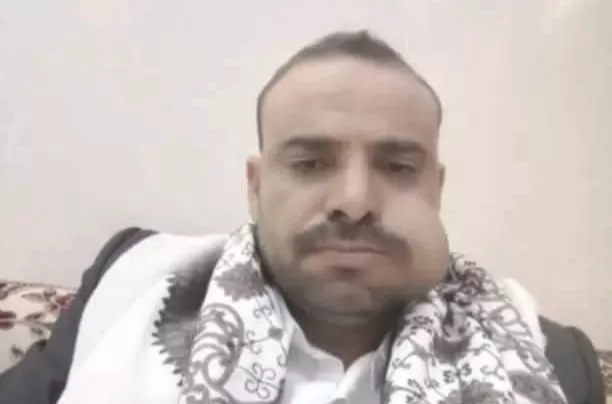 مقتل شيخ قبلي بارز برصاص الحوثيين في كمين مسلح بمحافظة عمران