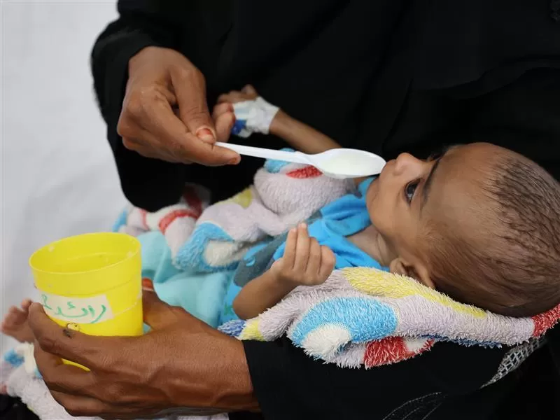 "أطباء بلا حدود" تحذر من خطر مجاعة وشيكة تُهدد آلاف الأطفال في اليمن