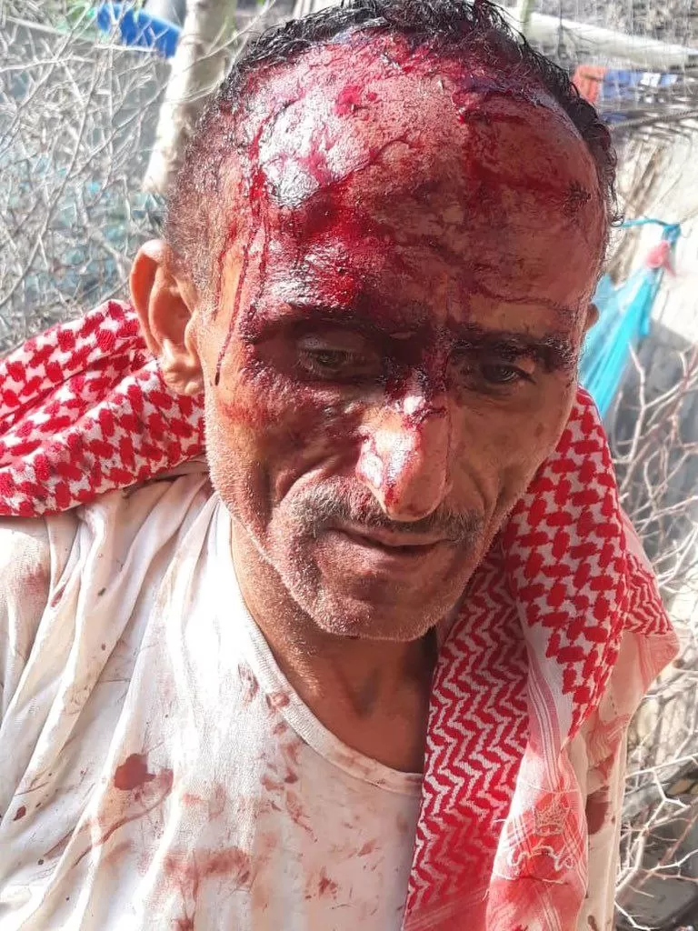 عناصر حوثية تعتدي بوحشية على مساعد طبيب أمام أسرته في إب