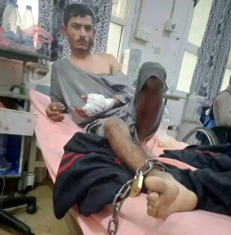الحوثيون يقيدون جريحًا بسلسلة حديدية داخل غرفة العمليات بمستشفى في صعدة