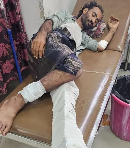 إصابة شاب برصاص قنّاص حوثي غرب تعز وسط استمرار استهداف المدنيين