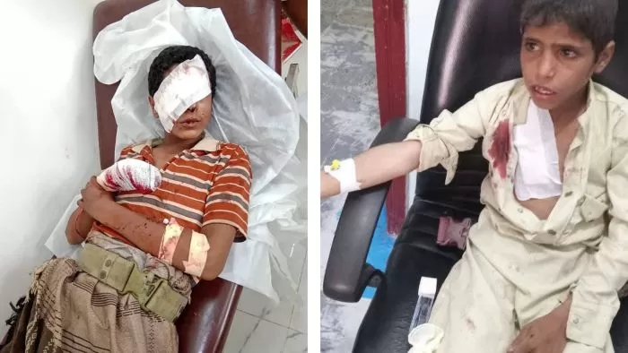 إصابة طفلين بانفجار قذيفة من مخلفات الحوثيين في الجوف