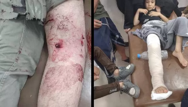 إصابة شاب وطفل برصاص قناص حوثي أثناء جلب المياه شرق تعز