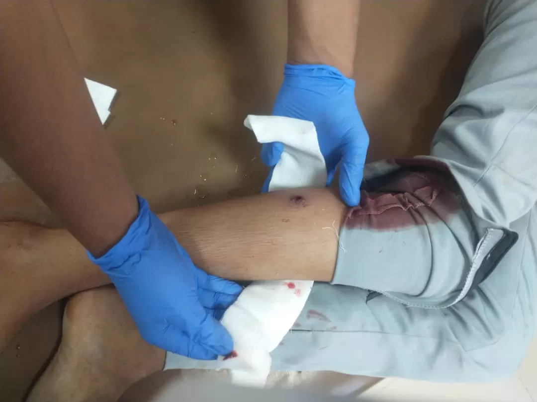 إصابة طفل  برصاص قناصة الحوثيين شمال مدينة تعز