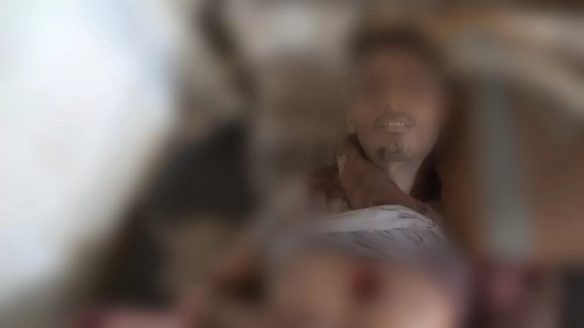 مقتل مدني وإصابة آخر في انفجار لغم حوثي جنوب الحديدة