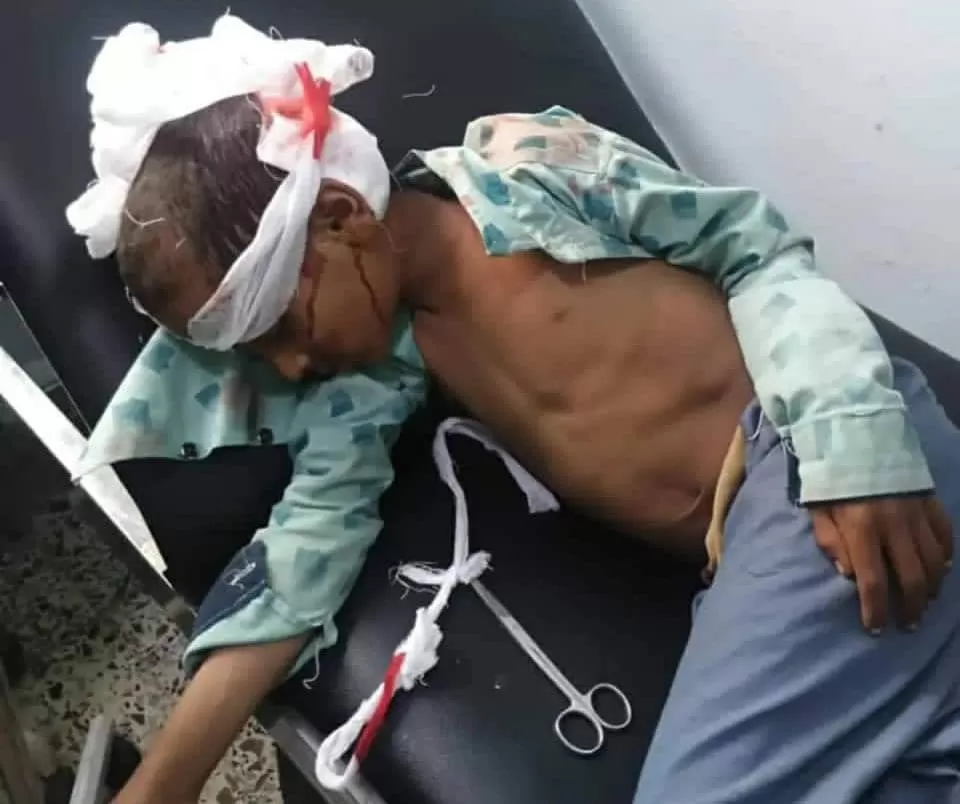 وفاة طفل في ذمار بعد تعثر وصوله للمستشفى بسبب فعاليات المولد