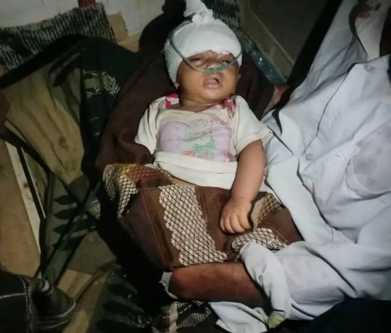 إصابة طفل رضيع في قصف حوثي استهدف منازل المواطنين غرب تعز