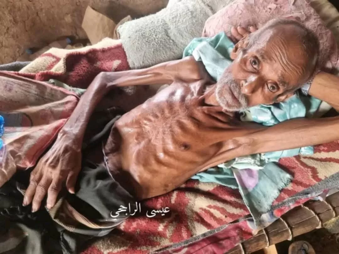 وفاة نازح مُسن نتيجة تدهور الأوضاع الإنسانية في مخيم المهربة بحجة