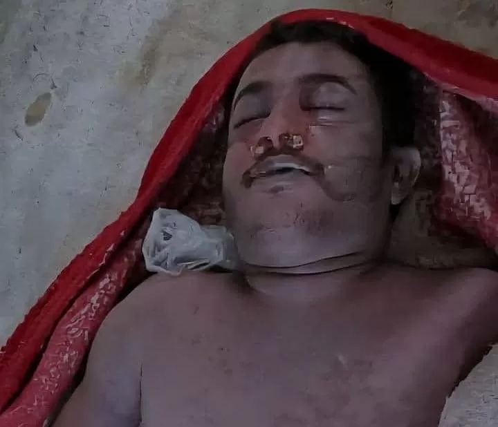وفاة شاب تحت التعذيب في سجون الحوثيين بعمران