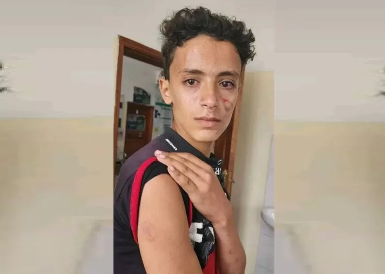 مشرف حوثي يعتدي بوحشية على طفل ووالدته في ريمة