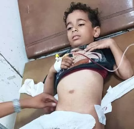 إصابة طفل برصاص قناص حوثي شرق تعز