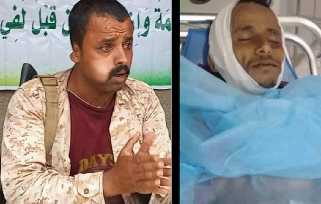 قيادي حوثي يقتل مواطناً أمام أسرته بعد نقاش حول أفكار الجماعة في الحديدة