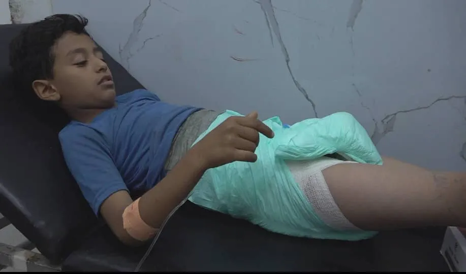 إصابة طفل برصاص قناص حوثي شرق مدينة تعز