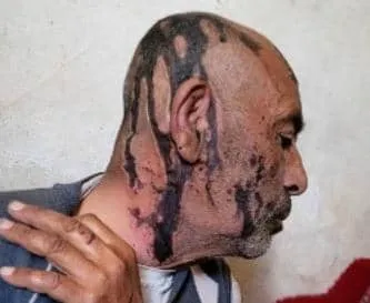 عنصران حوثيان يعتديان على والدهما المُسن في عمران والأمن يرفض ملاحقتهما