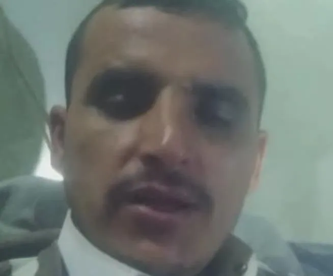مسلحون يعتدون على مُنشد شعبي في عمران وينهبون ممتلكاته