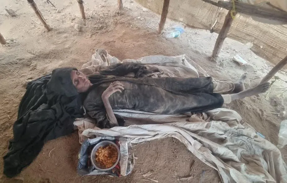 وفاة امرأة جراء الجوع والمرض في مخيمات النازحين بحجة