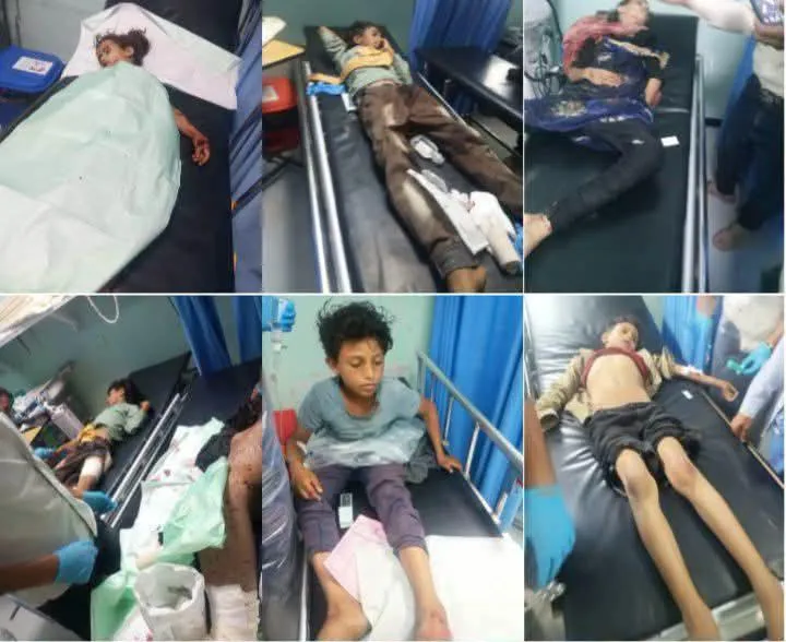 مقتل 4 أطفال وإصابة 9 آخرين بانفجار من مخلفات الحوثيين في الضالع